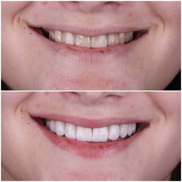 Slider image (1) Odonto Liuzzi - Dental Clinic in Rio de Janeiro, Brazil